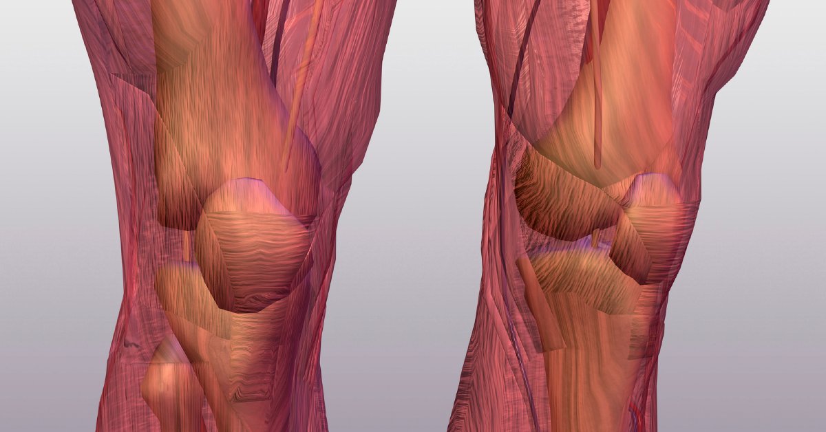 WebMD's tweet photo. Did you know if you drop 10 pounds, and you’ll take as much as 40 pounds of force off your knees? Learn how to protect the biggest and strongest joints in your body: https://t.co/oMoNnVBqjy https://t.co/iFJ38n7JsM