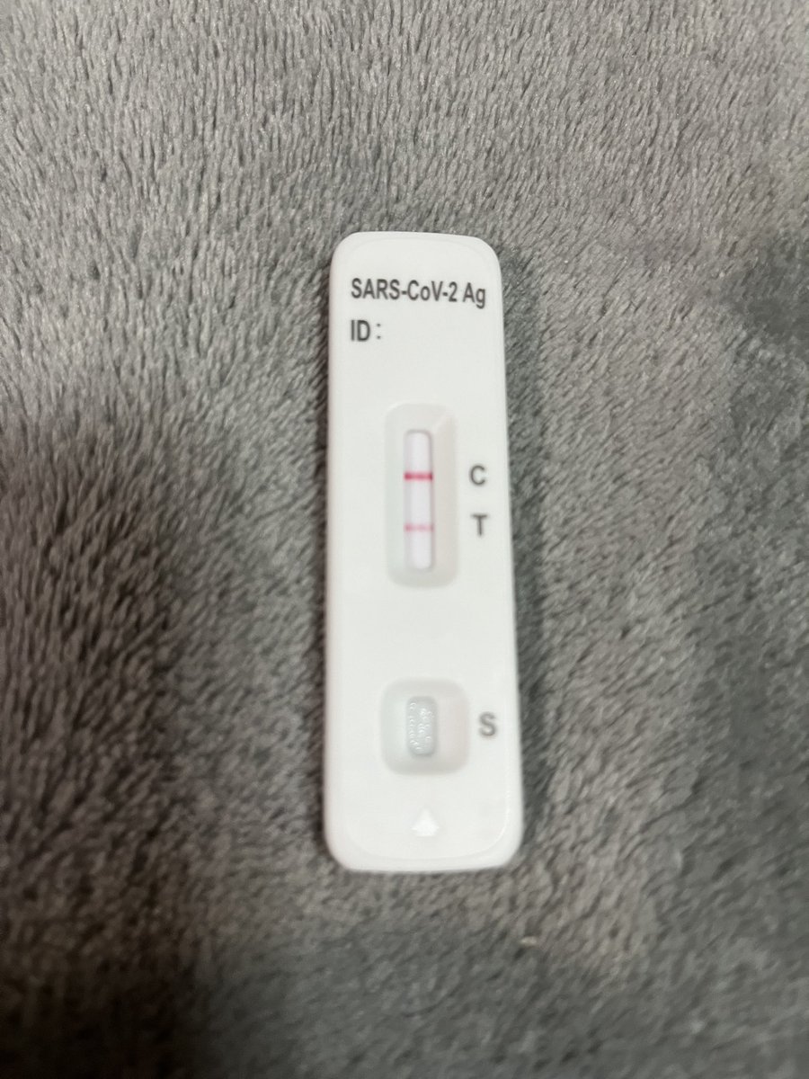 R3N4Y_'s tweet image. In the last 3 weeks 

Flu ✅ 
Laryngitis after the flu ✅
And now this 👇🏼😭 I’m seriously done!! #COVID19 #screwyou