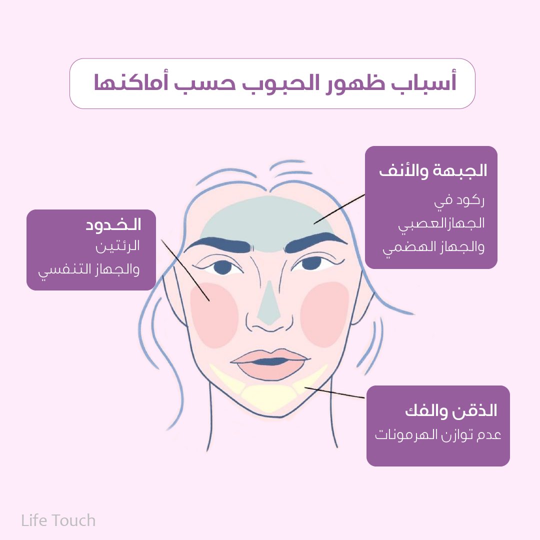 اسباب ظهور الحبوب في الوجه