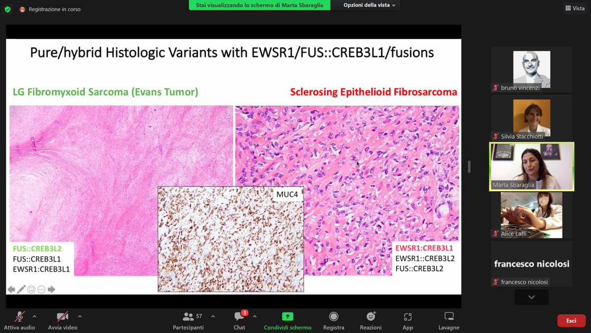 ItaSarcomaGroup's tweet photo. The last journal of the year. This is about @ASCO and @AACR updates. Here Marta Sbaraglia great collaborator or @apdeitos is presenting new challenging entities (1/6) https://t.co/ZeVdBUHluX