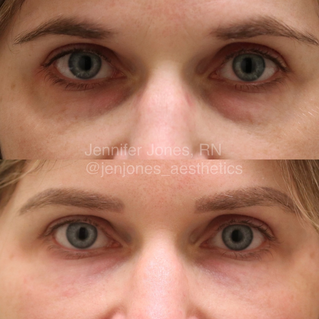 Nayak Plastic Surgery & Avani Derm Spa tweet media