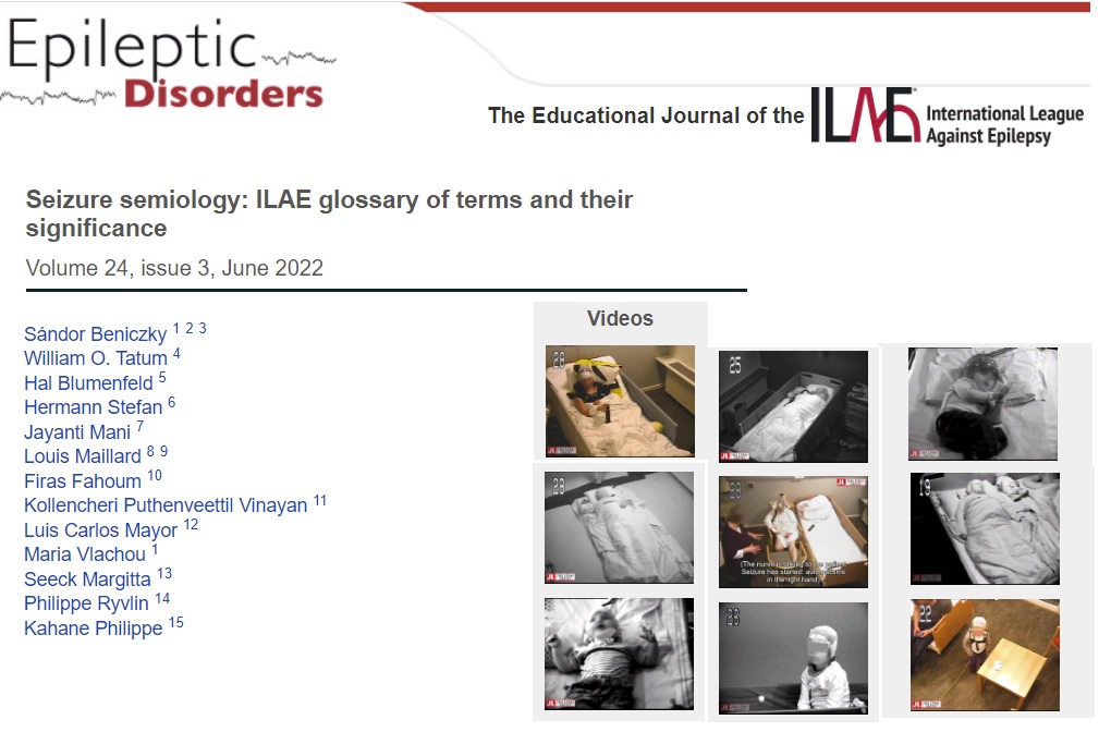 SBeniczky's tweet photo. The revised ILAE Semiology Glossary is now available on PubMed / Open access. Lots of good educational videos 🙂
https://t.co/LLz8kplQ7H
#epilepsy #EEG  @fabnascimen @IlaeWeb  @EpiDisorders https://t.co/P5A1Nk0g2C