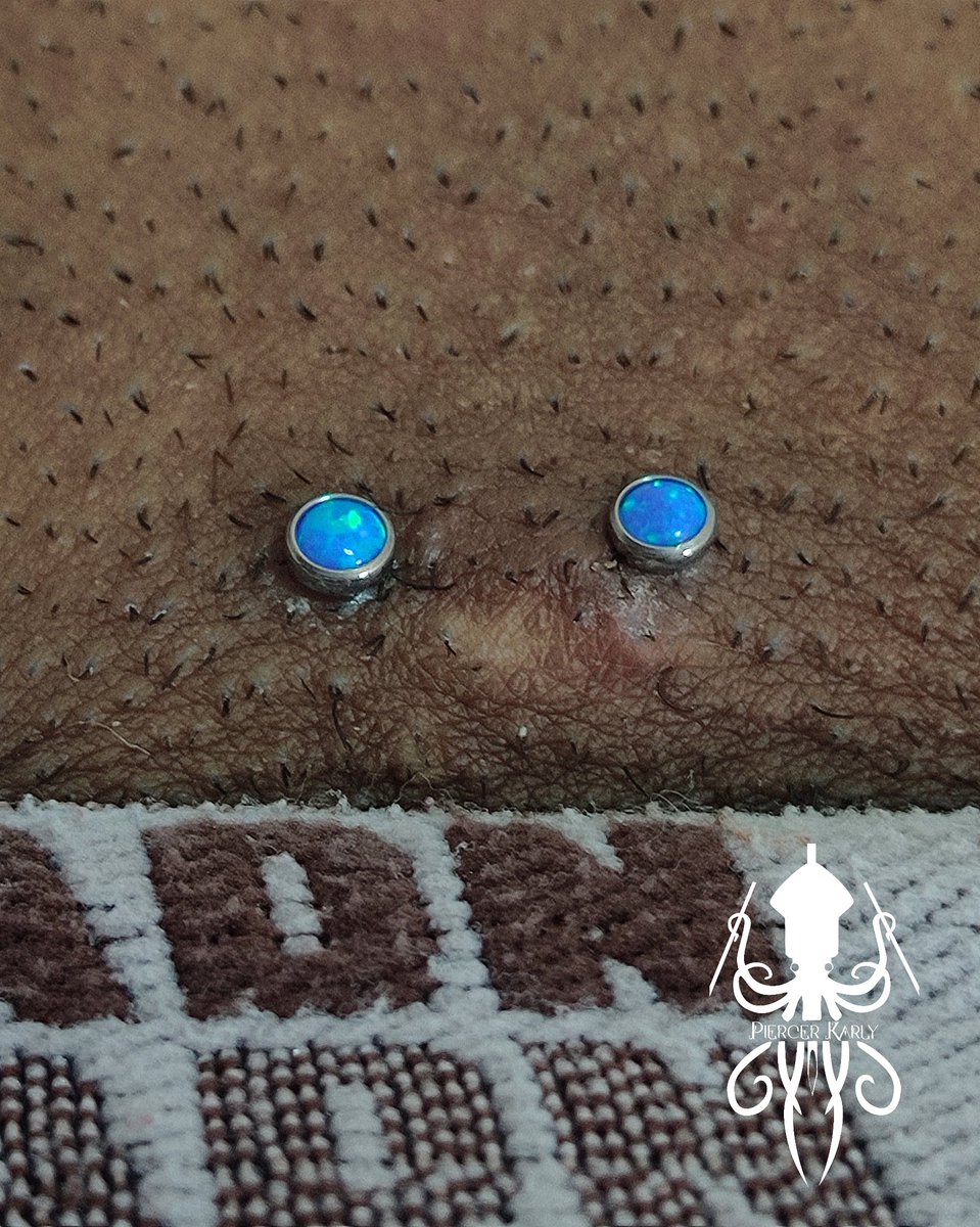 KarlyPiercer's tweet photo. Pubic realizado com surface
Procedimento com 40 dias de cicatrização! 
Topos em opala azul 4mm https://t.co/W7eYK7bQK6
