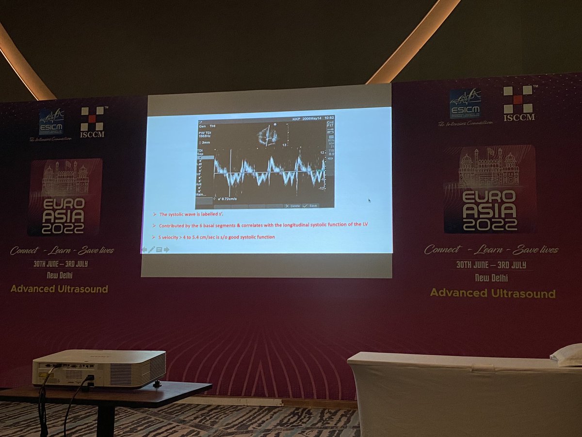 Nice echo course in Delhi today with our indian friends