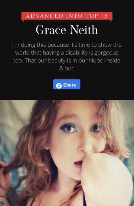 Please keep voting!! https://t.co/vBV7C72SAO The votes cumulate through the group round, so i have to<a href="/tag/redhead"class="tags"><span>#redhead</span></a><a href="/tag/vote"class="tags"><span>#vote</span></a><a href="/tag/amputee"class="tags"><span>#amputee</span></a><a href="/tag/disabilityinclusion"class="tags"><span>#disabilityinclusion</span></a><a href="/tag/amputeegirl"class="tags"><span>#amputeegirl</span></a>