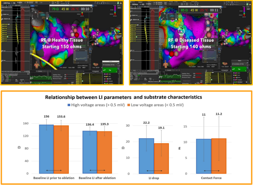 BSC_EU_Heart's tweet photo. #LocalImpedance drop may provide insights about lesion creation as the process significantly differs during RF according to voltage level.
On slide 9-10, you can learn from @SegretiLuca et al. how #STABLEPOINT guides efficient PV isolation: https://t.co/yTFMW0yvT1
#BSCEMEA https://t.co/uKwArHzFye