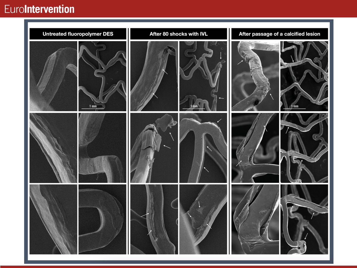 EuroIntervention tweet media