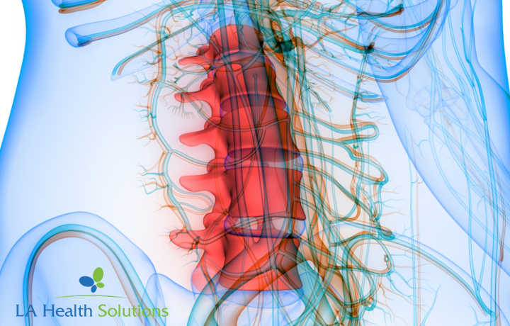 LAHSolutions_1's tweet photo. What Is A Facet Joint Syndrome?
Learn more: https://t.co/M7NPtbqkfs

Call the LA Health Solutions' Team Today! 
844-496-LAHS (5247)

​#LAHealthSolutions https://t.co/thmCpG3CjP