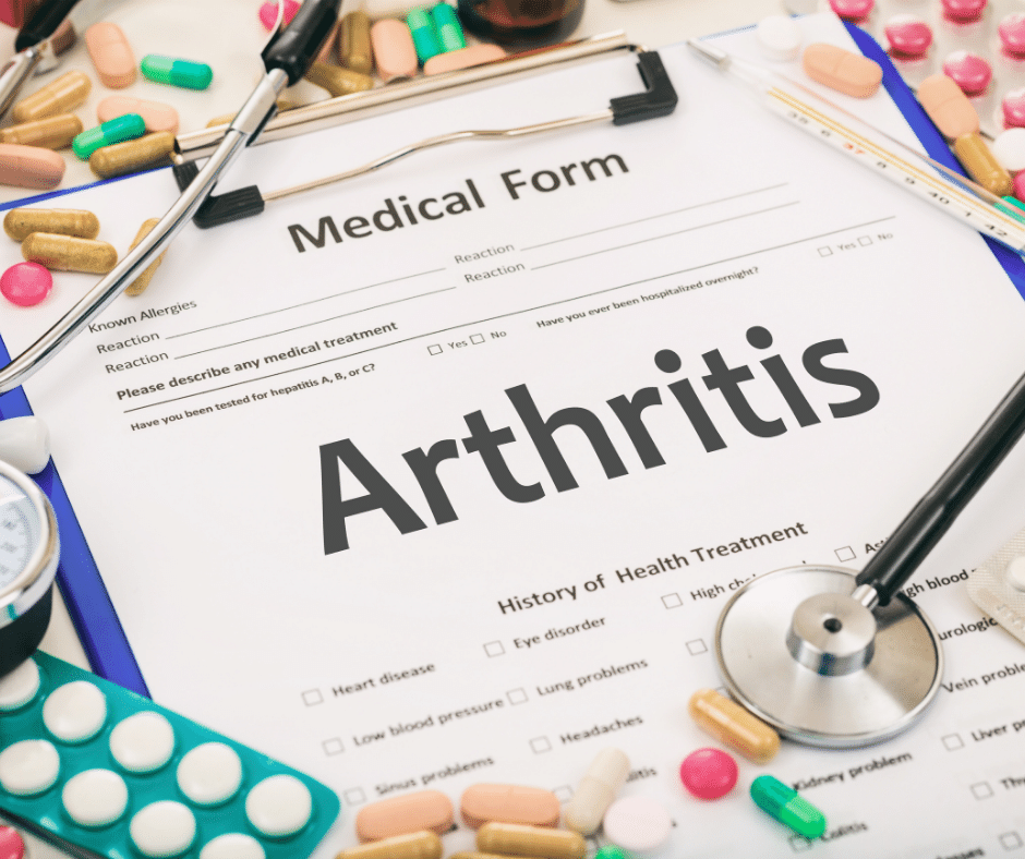During arthroscopic surgery, your surgeon can also smooth arthritis in your joints. Consider this an added bonus to potentially improve mobility. rb.gy/bzwkpw