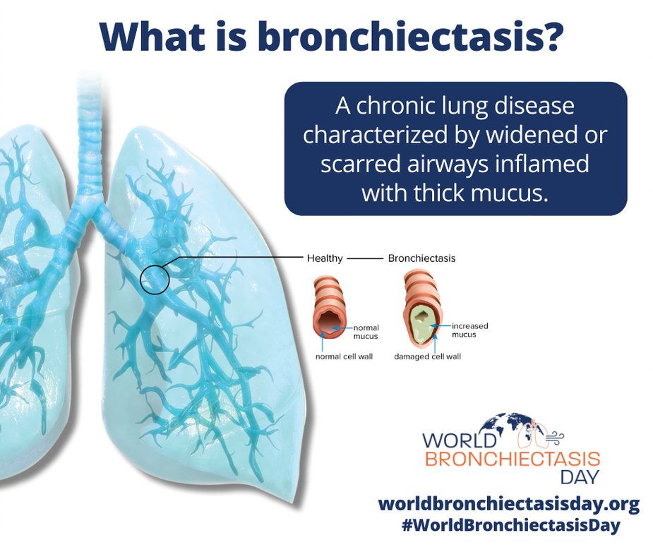American Thoracic on Twitter "Today is WorldBronchiectasisDay. Bronchiectasis is a lung