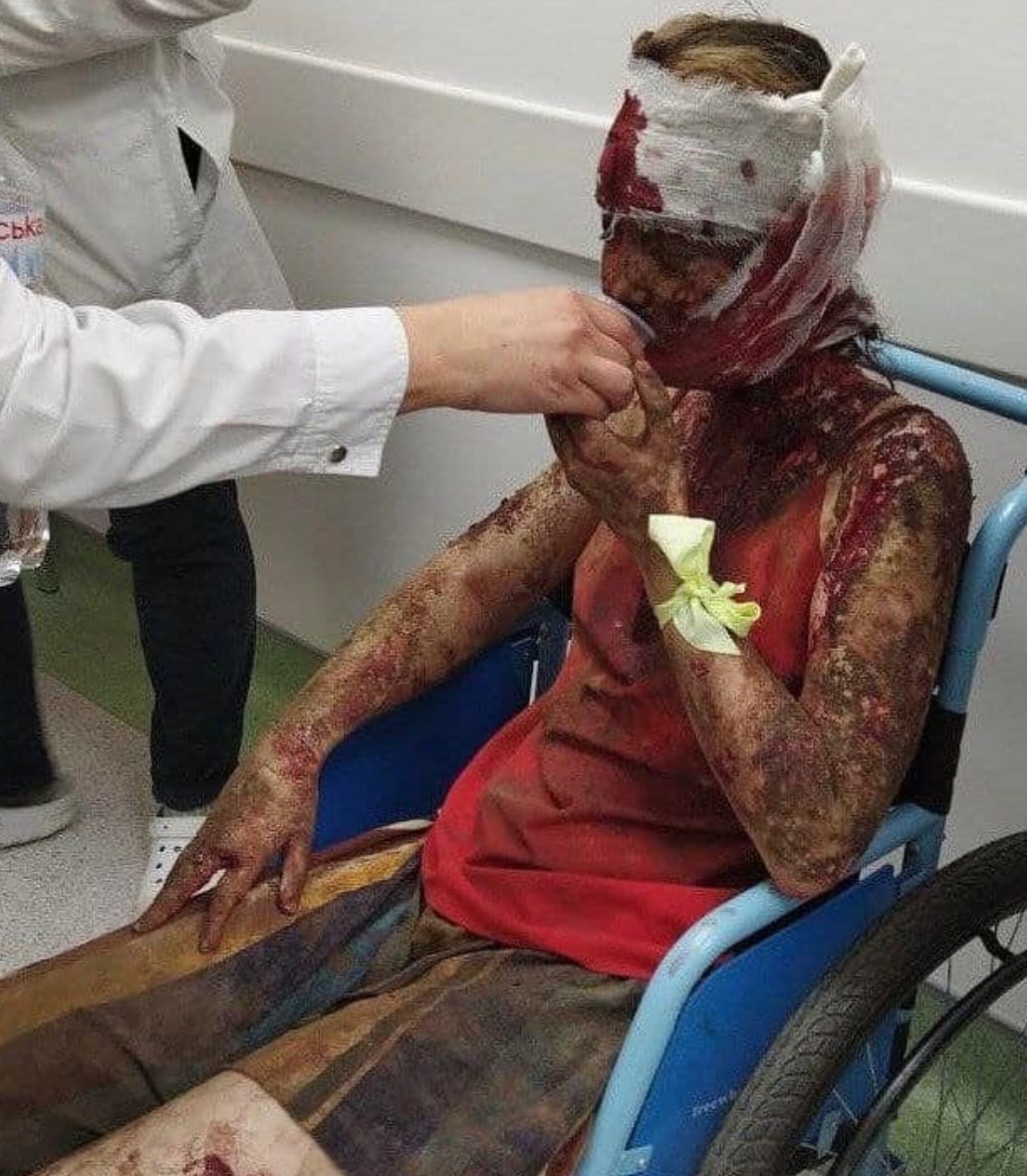 Lyla_lilas's tweet photo. Thread:
 20 - year - old Olena Bezus miraculously survived a missile attack by russians at the mall in Kremenchuk. That day, the girl was at work in the "Amstor" shopping center. A young man whose name is unknown to Olena helped her out of the burning and destroyed building. https://t.co/4fjXVFvqzc