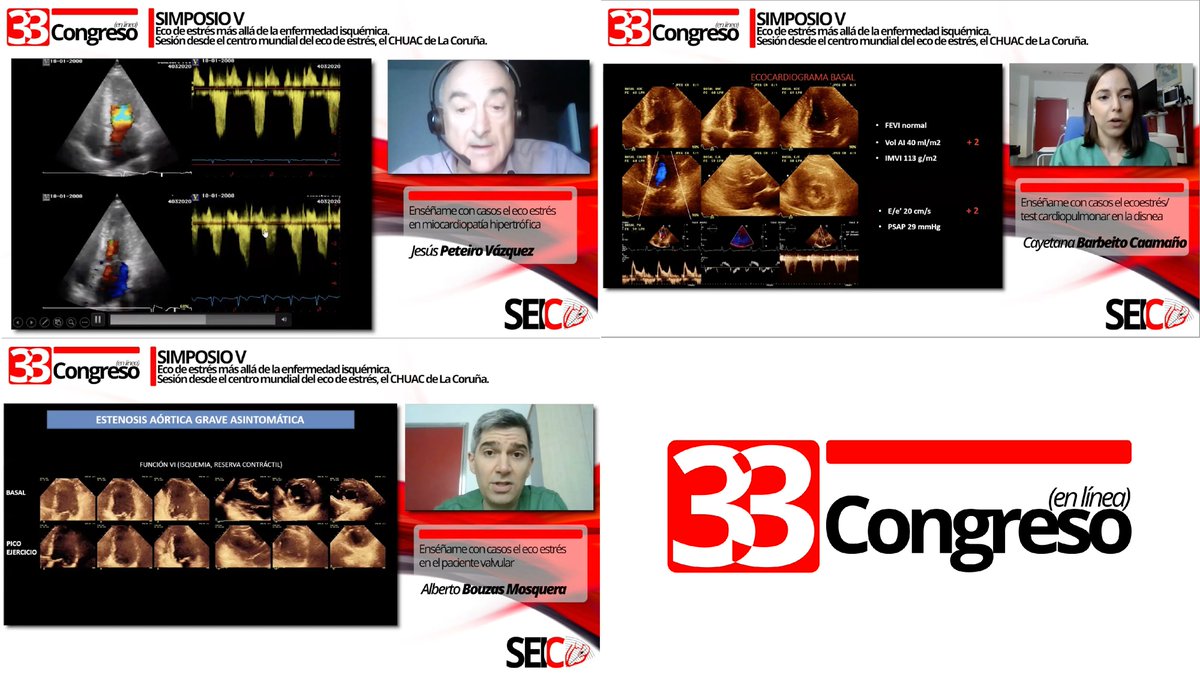 ImagenCardiaca's tweet photo. Eco de estrés más allá de la enfermedad isquémica
Test cardiopulmonar en la disnea - Cayetana Barbeito - https://t.co/yLlekEvR9k
En miocardiopatía hipertrófica - Jesús Peteiro - https://t.co/DRzS8BQ8rb
En el paciente valvular - Alberto Bouzas - https://t.co/b9SDr4vnNC
#33SEIC https://t.co/Daw0UvgbbX