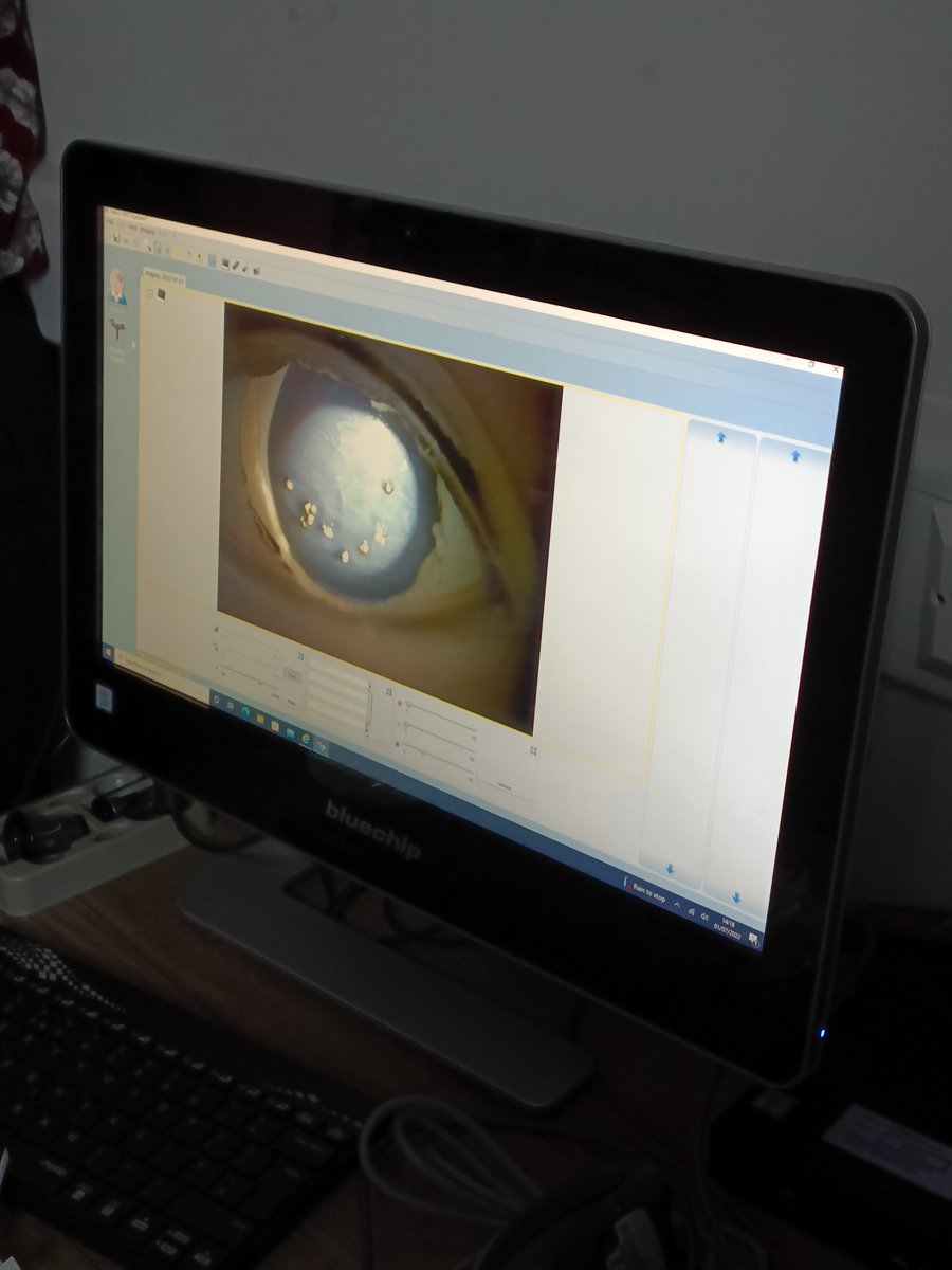 Thank you to East Lancashire Hospital Trust and Scope eyecare for hosting a training session today on foreign body removal. It was a fantastic event.   

<a href="/ELHT_NHS/">East Lancashire Hospitals NHS Trust 💙</a> 
<a href="/ScopeEyecare/">SCOPE</a>