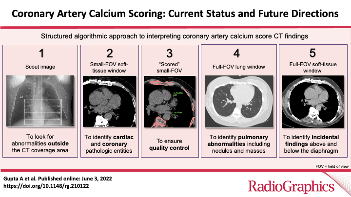 Coronary Artery Calcium Scoring: Current Status and Future Directions Gupta A et al Cardiac Imaging doi.org/10.1148/rg.210… @AmitGupta_83 @hopelessk @MaharshiRajdev @UHRadiology @UH_RE_Institute #RGphx 3/20