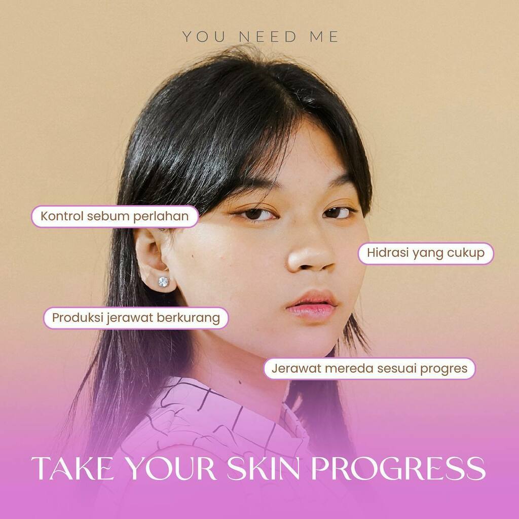 youneedme_id's tweet photo. ✨ PROSES ITU NENTUIN HASIL ✨
Siapa yang nyuruh kamu cepet” cantik, cepet” glowing, cepet” langsing, cepet” baik, cepet” happy

😙bestieeee take your time, dealing with your progress, and enjoy every step

Kita seringkali terkungkung sama stigma kalau semua itu harus cepet. Pa… https://t.co/7I0tEU9jJS