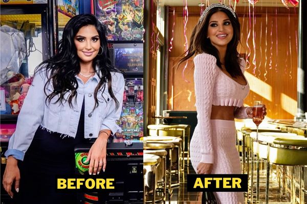 leva bonaparte plastic surgery Image 5