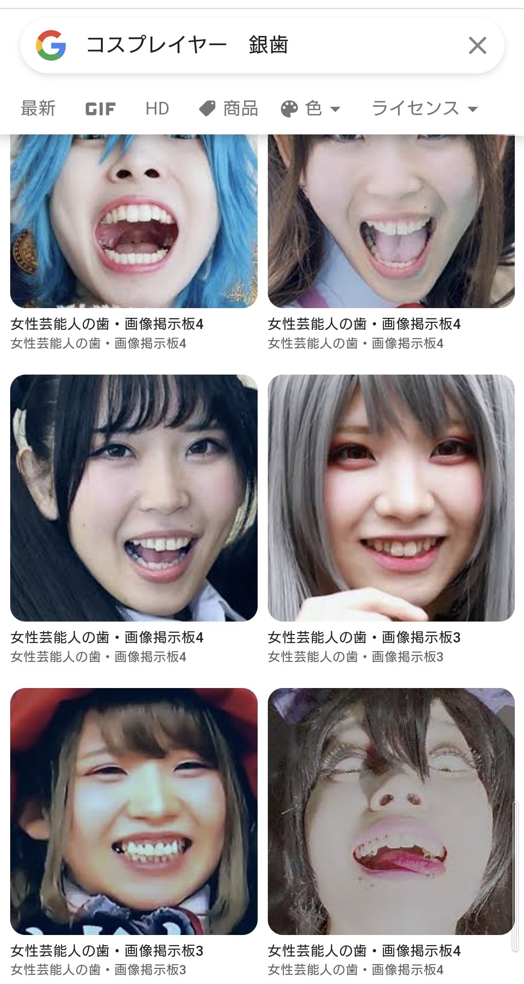女性芸能人銀歯画像 凄い検索ワード見つけてしまった・・・ 「コスプレイヤー 銀歯」 彼女達、一般人なので芸能人のようにセラミックで隠してないし。  だけど、写真あげる自信あるだけに可愛い子多いし。 しかも、口開けたの含めて色んな写真あげてるし。 マジで素材の宝庫 ...