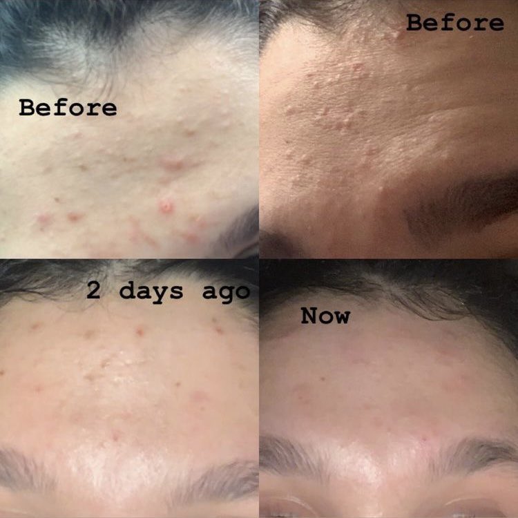 reviewhaul's tweet photo. moisturizer untuk memperbaiki skin barrier

- a thread - https://t.co/Iakkqf8lQO