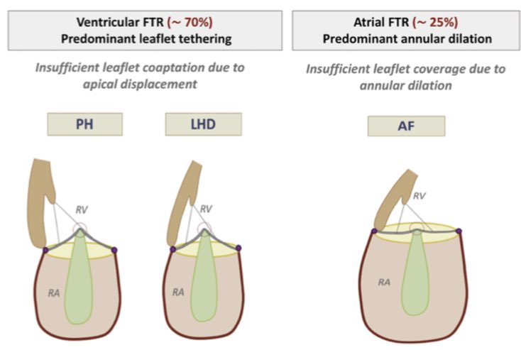 Denisa Muraru (@denisamuraru) on Twitter photo Right Heart, Right Now: The Role of #3DEcho
authors.elsevier.com/a/1fLEA3BS3sTP…
Grateful to my mentors, research fellows and colleagues for their support and to <a href="/ASE360/">American Society of Echocardiography</a> for this unique opportunity
authors.elsevier.com/a/1fLEA3BS3sTP…
<a href="/lpbadano/">Luigi</a> <a href="/mikepicardmd/">Michael H Picard</a> <a href="/robertomlang/">Roberto M Lang</a> <a href="/hahn_rt/">RTHahnMD</a> <a href="/bogdan_popescu1/">Bogdan A. Popescu</a> Right Heart, Right Now: The Role of #3DEcho
authors.elsevier.com/a/1fLEA3BS3sTP…
Grateful to my mentors, research fellows and colleagues for their support and to <a href="/ASE360/">American Society of Echocardiography</a> for this unique opportunity
authors.elsevier.com/a/1fLEA3BS3sTP…
<a href="/lpbadano/">Luigi</a> <a href="/mikepicardmd/">Michael H Picard</a> <a href="/robertomlang/">Roberto M Lang</a> <a href="/hahn_rt/">RTHahnMD</a> <a href="/bogdan_popescu1/">Bogdan A. Popescu</a>