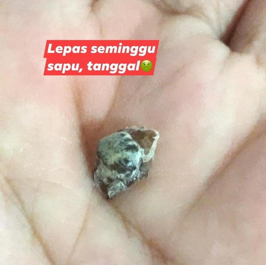 shopeesale's tweet photo. Maaf la geli sikit tengok gambar. Tapi masalah ketuat ni mmg susah nak jumpa ubat. Orang dulu guna lilin, tapi aku tak sanggup 🥵 . kawan aku rekomen ubat ni. Lepas seminggu sapu dgn konsisten, tangga!

kena try 👉🏻👉🏻 https://t.co/zvyFnFZ1B7 malu kalau ada orang tegur 😭🥹 https://t.co/ncJbEKjD6L