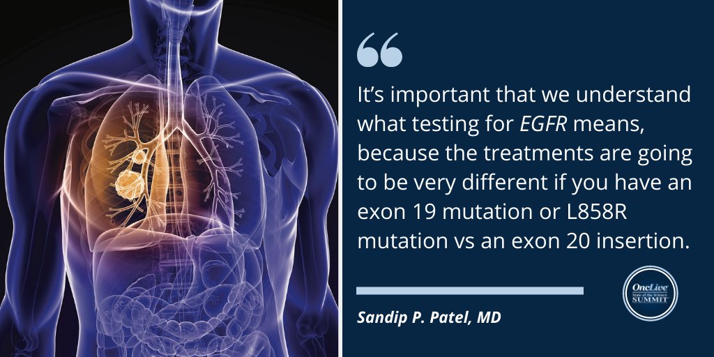 OncLive SOSS (@onclivesoss) on Twitter photo Sandip P. Patel, MD, of <a href="/UCSDCRCERA/">UCSD Health Moores Cancer Center CRCERA</a>, discusses frontline immunotherapy in advanced NSCLC, the treatment of patients with EGFR- and KRAS G12C–mutant and EGFR exon 20 insertion–positive disease, and the management of stage III disease #lcsm ow.ly/Cp3s50JMN1W Sandip P. Patel, MD, of <a href="/UCSDCRCERA/">UCSD Health Moores Cancer Center CRCERA</a>, discusses frontline immunotherapy in advanced NSCLC, the treatment of patients with EGFR- and KRAS G12C–mutant and EGFR exon 20 insertion–positive disease, and the management of stage III disease #lcsm ow.ly/Cp3s50JMN1W
