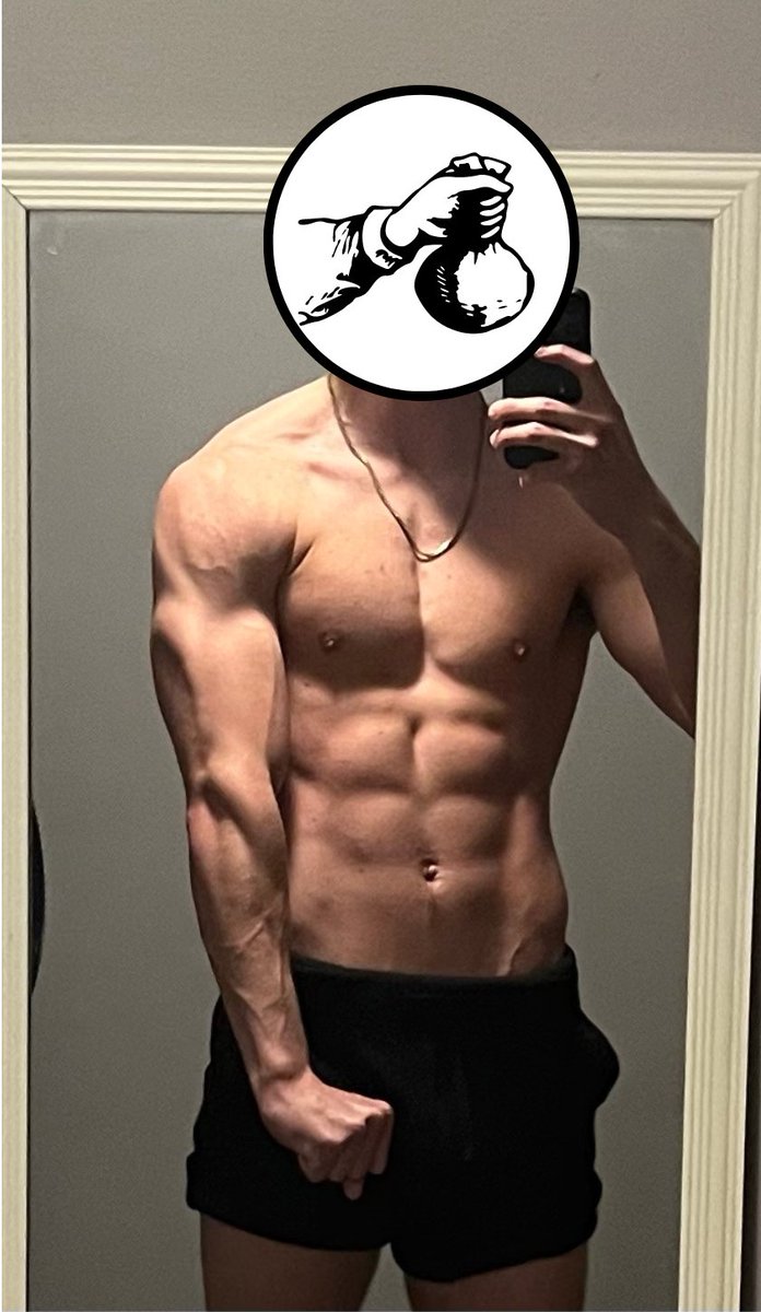 I was born with "Pectus Excavatum"; a sunken breastbone (see left image