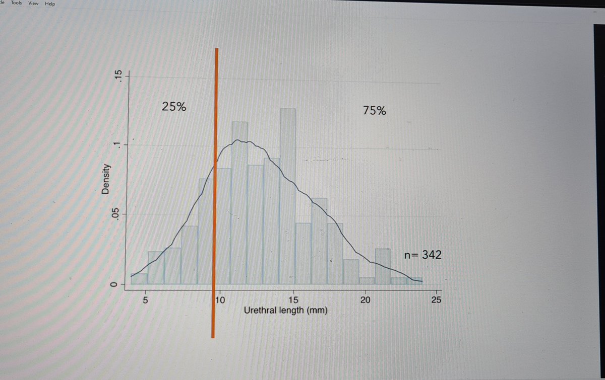 Alastair Lamb (@lambalastair) on Twitter photo <a href="/mercaderclaudia/">Clàudia Mercader</a> presents nice video on different approaches to apex in #RARP from #Oxford_Urology.
Principle = preserve structures to optimise urethral stability where poss without compromising margins
•MUL > 10mm is important for cont
•Stable MUL even more so (OR4.3x)
#EAU22 <a href="/mercaderclaudia/">Clàudia Mercader</a> presents nice video on different approaches to apex in #RARP from #Oxford_Urology.
Principle = preserve structures to optimise urethral stability where poss without compromising margins
•MUL > 10mm is important for cont
•Stable MUL even more so (OR4.3x)
#EAU22