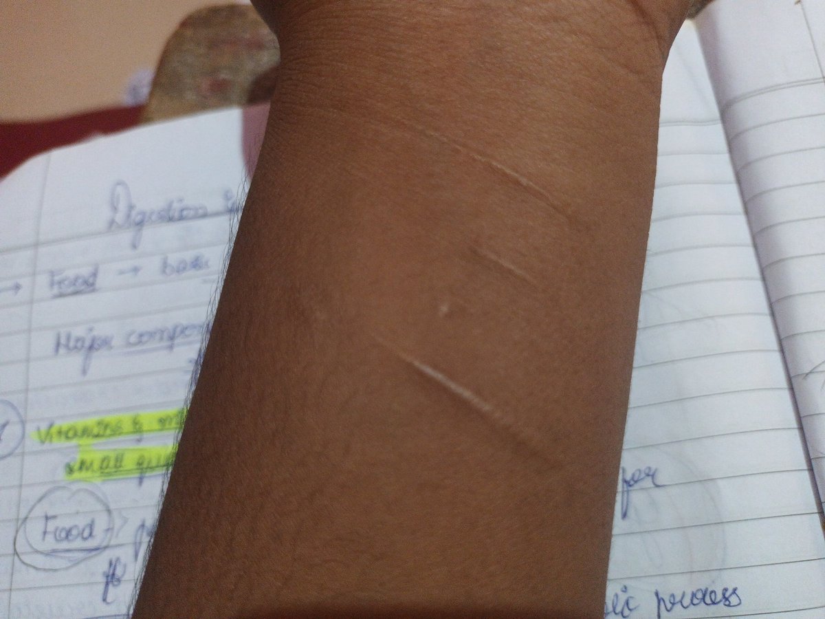 dentodontics's tweet photo. A Heartwrenching msg by a student 
#CandleMarchForNEETUG
Sir I beg u I will fall on your feet ..please postpone the exam.. I am 2nd year dropper sir ..after so many cuts last year my parents allowed me to take 2nd year drop sir 
Do hear them 
@dentodontics 
@anubha1812 https://t.co/YjpaR7myic