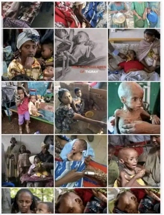 @gebrhiowt_yisakVery heartbreaking !!😭😭💔💔!PLEASE STOP IGNORING! the children of #tigray are SUFFERING, imagine this baby was yours! VERY PAINFUL to watch 😭😭 Please help NOW!#600DaysIsTooLong
#TigrayFamine  
@micdunford
@WFP
@PowerUSAID
@UNICEF
@UNOCHA
@USAmbUN
 @UN
