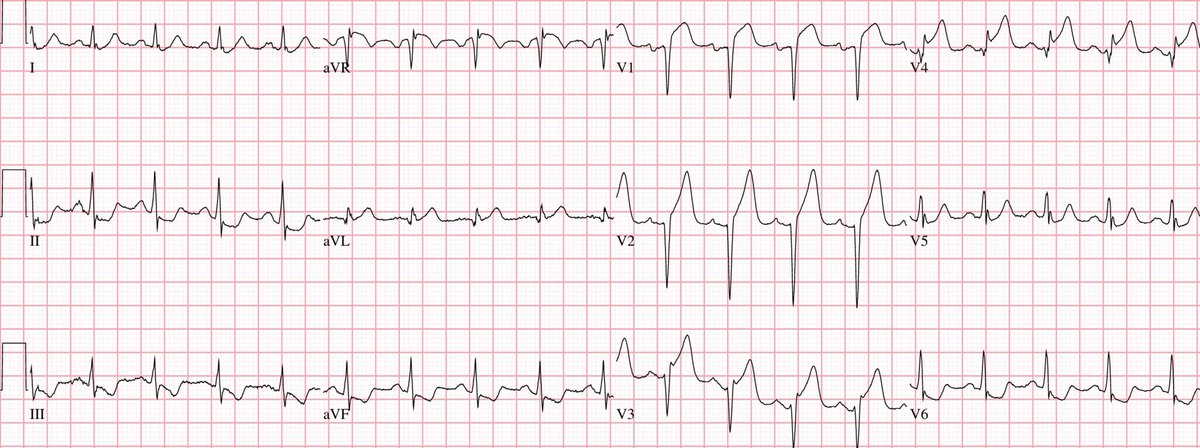Sam Ghali, M.D. tweet media