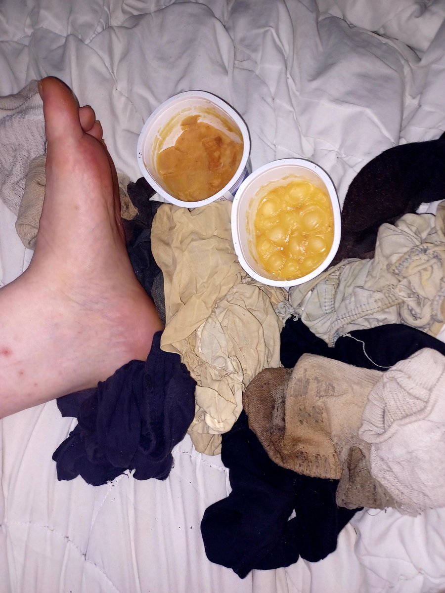 cheese_chub's tweet photo. #smegma #chub #feet #gaychub #raunch #cheesecock #cheesyfeet #chubfeet https://t.co/NjppSbuTyl