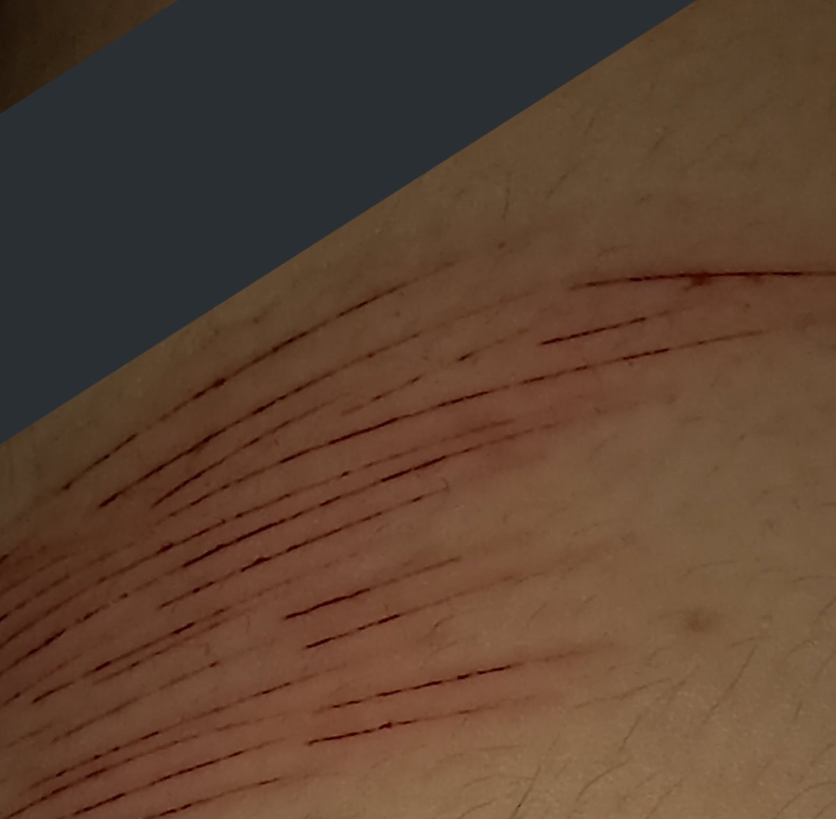 hanlyun1's tweet photo. #자해 #자살 #selfharm #自害 
처음으로 허벅지에 해 봤어요 헤헷 https://t.co/dmokxUxeqq