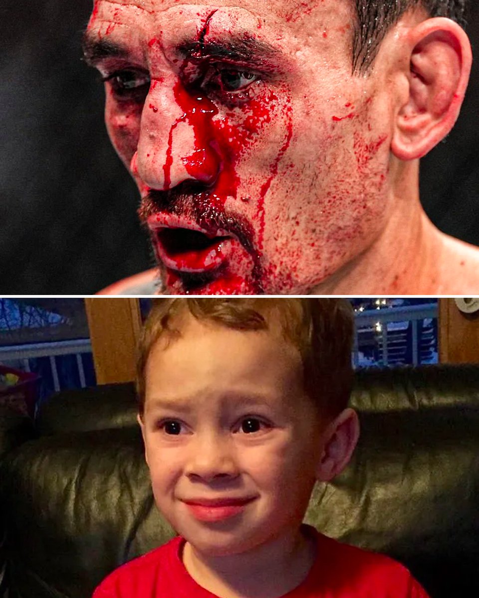 😬 #UFC276