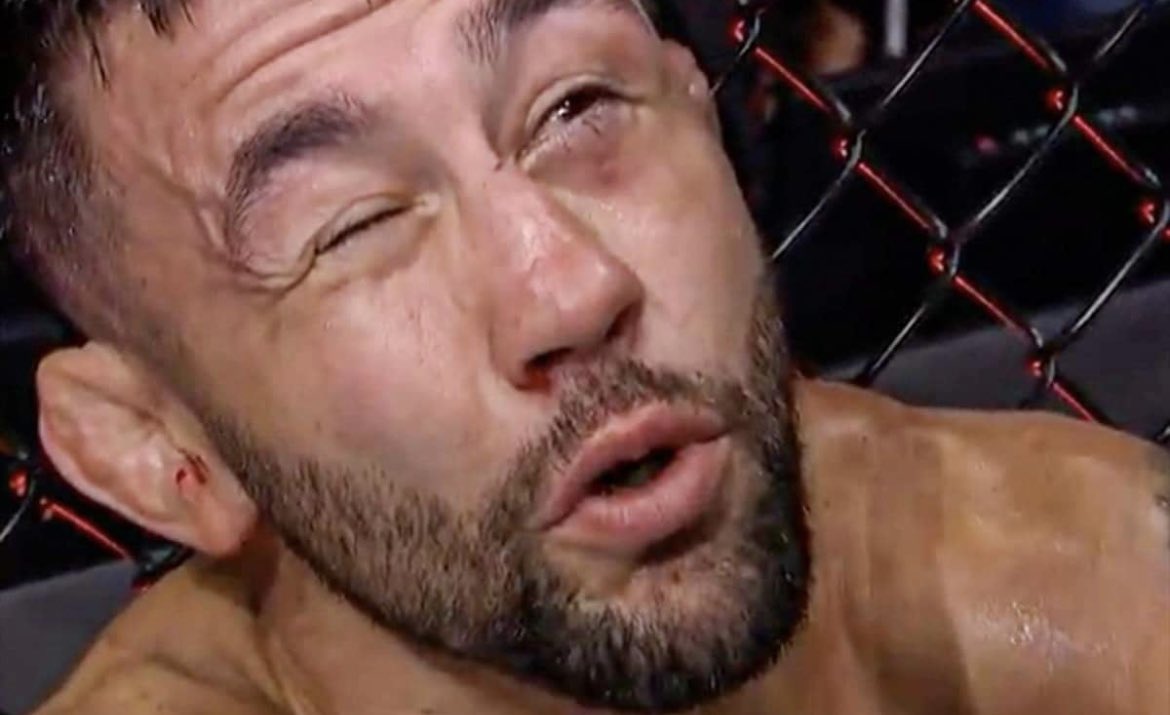 Home_of_Fight's tweet photo. European Fan trying to stay awake to watch Adesanya fight https://t.co/Nbiiq6FiSM