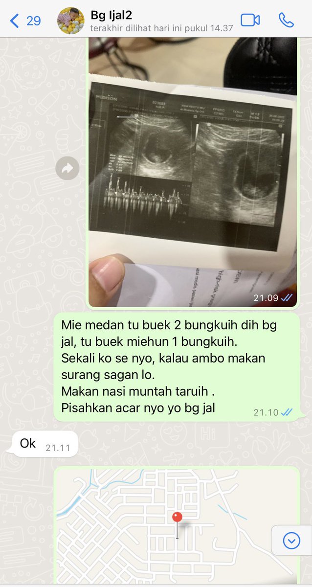Setelah suami, ijal adalah orang ke 2 untuk ngadu soal perngidaman w wkwk
