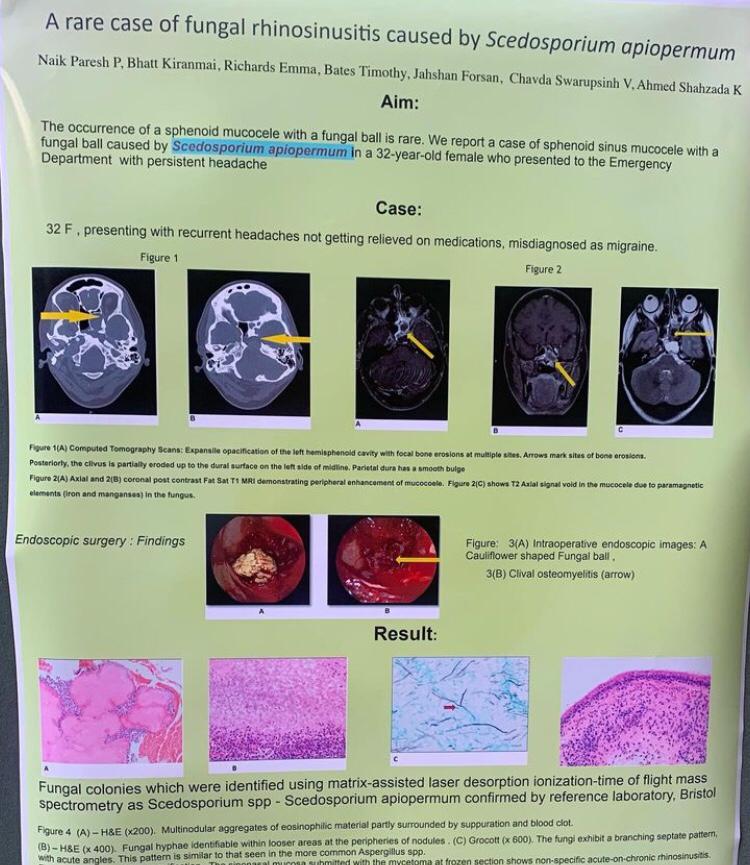 UHB Skull Base Team tweet media