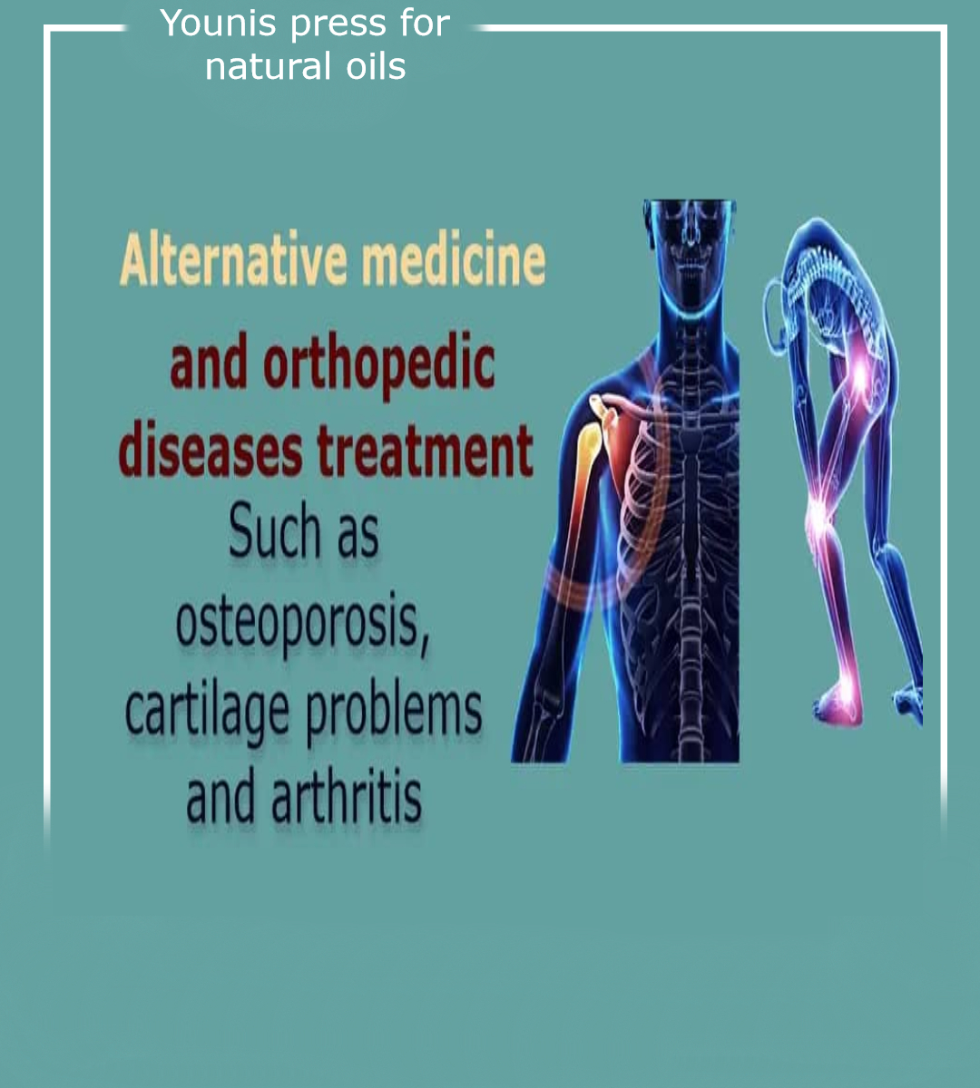 amrmoha38735766's tweet photo. Bone disease affects about 30% of people.
What are bone diseases, what are their causes and how to treat and prevent?
Enter the following link to view:
https://t.co/EOy7PT05SY

#Orthopedic_diseases #arthritis #cartilage https://t.co/6BtTP2tsuk