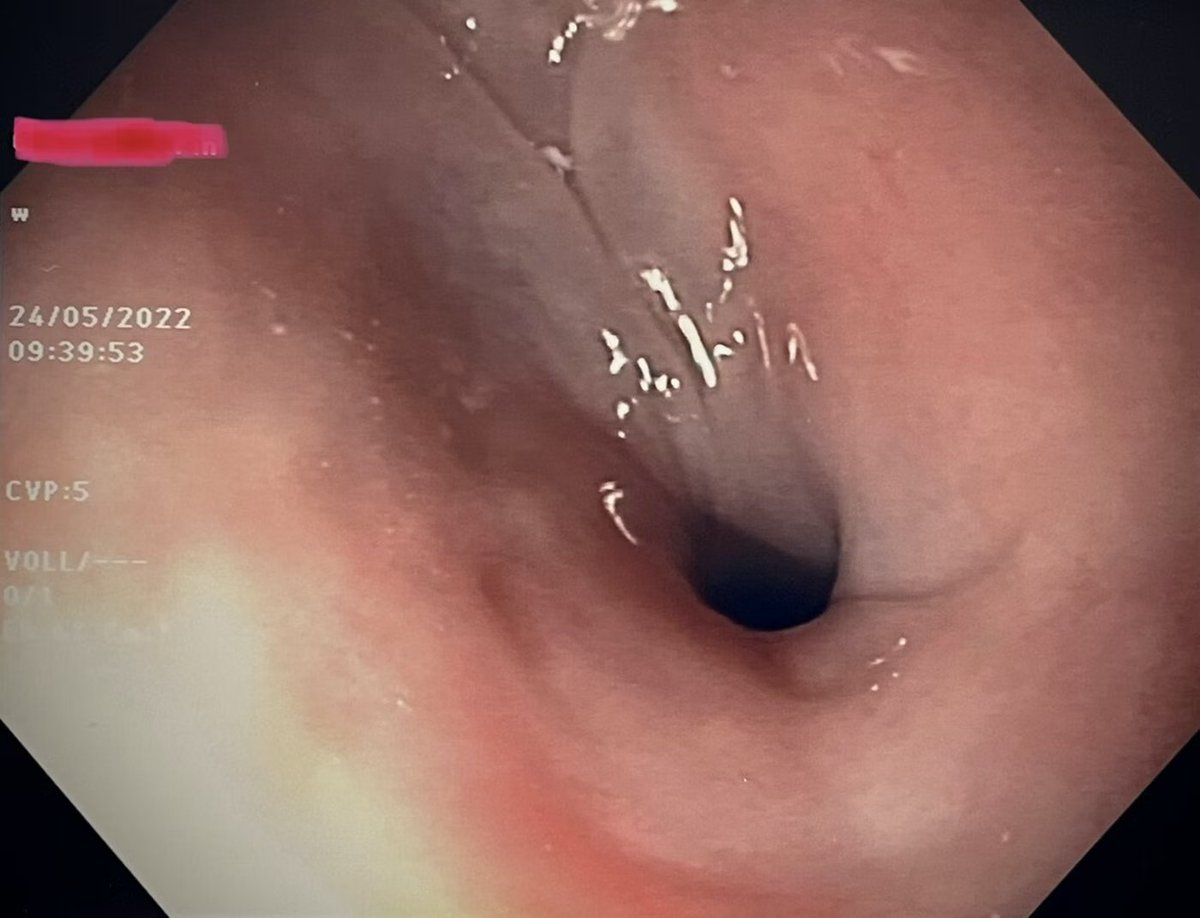 EndoCollab™ | GI Endoscopy Community tweet media