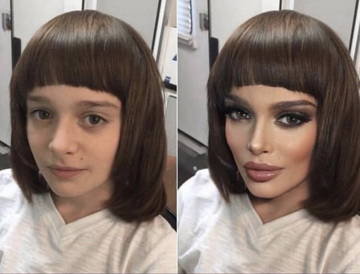 chipmunkemoji's tweet photo. before &amp; after pics me takinga shit https://t.co/vif8Nsln3X