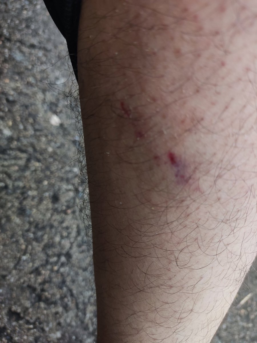 AnaCavouto's tweet photo. @LosOlivosInfo en la casilla de policial plaza chipa,está un perro muy bravo , amarrar a ese perro https://t.co/BriGqZ997c