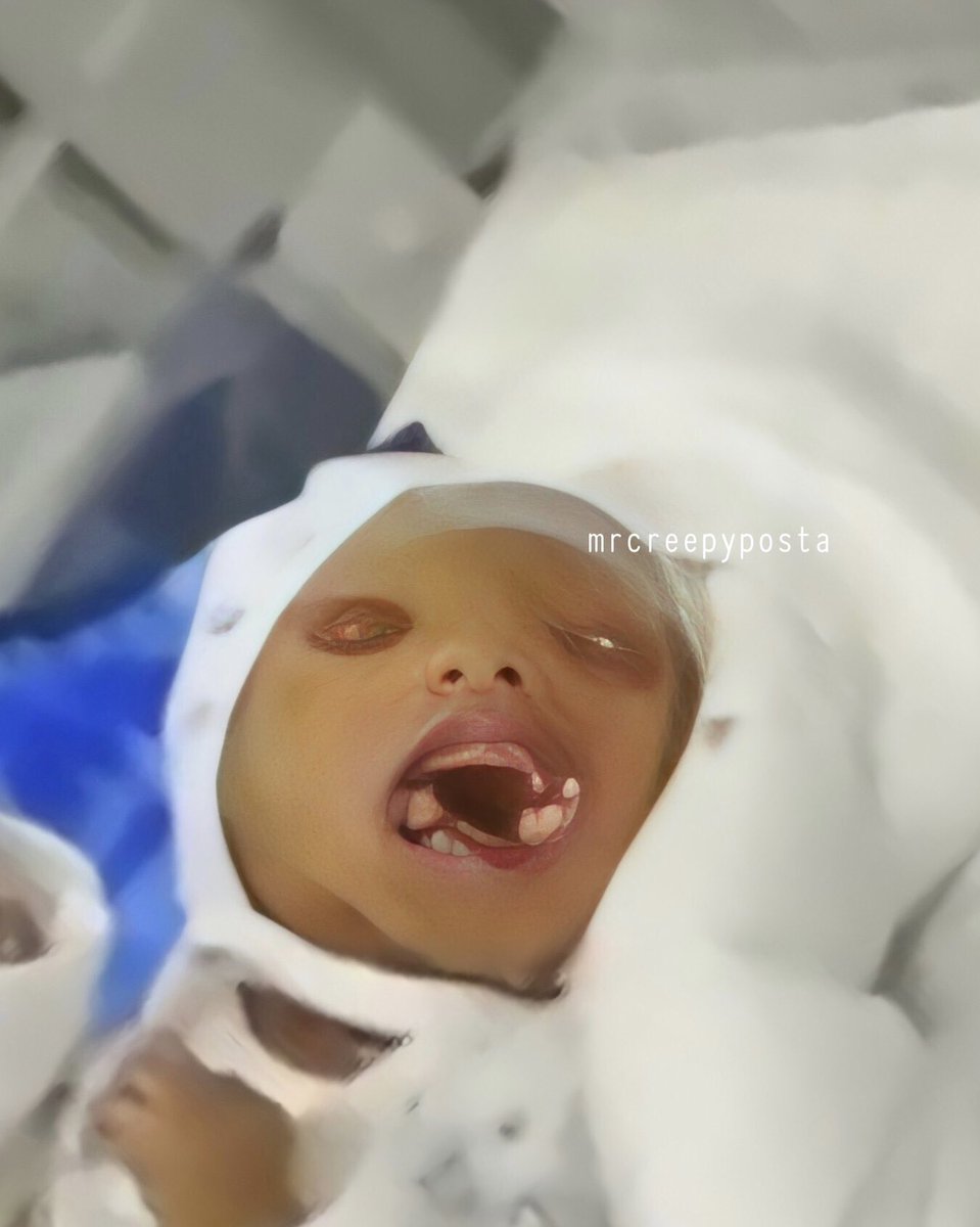 mrcreepyposta's tweet image. SWEET HOME ALABAMA!
‘Diharamkan kepada kamu berkahwin dengan ibu-ibu kamu, dan anak-anak kamu, dan saudara-saudara kamu’ ~ An-Nisaa:23

Seandainya larangan ini tidak dipatuhi, maka lahirlah anak malang tidak berdosa seperti di Dustlik, Uzbekistan baru-baru ini. 

Begini kisahnya.