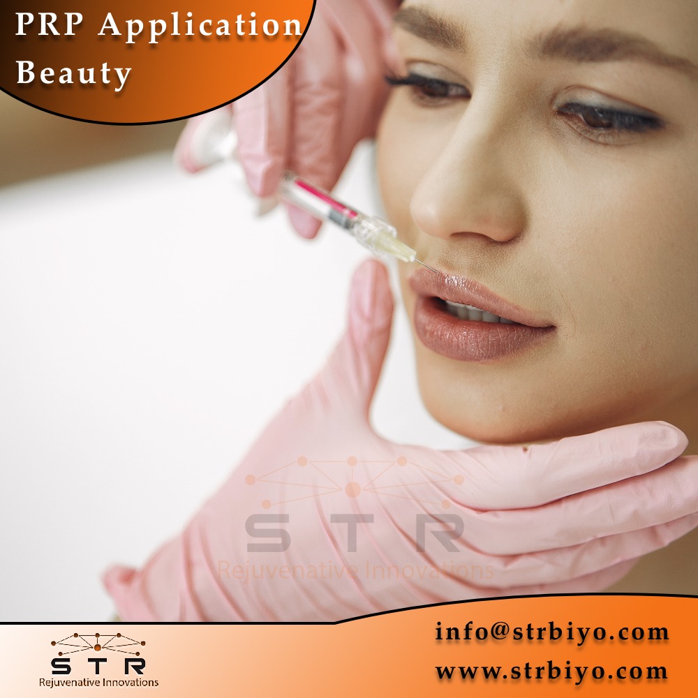 PRP APPLİCATİON BEAUTY

A special portion separated from your own blood to help heal your skin is applied to the entire face to assist in facial rejuvenation, repair and healing.

#prpinjection #prpapplications #prp #prpmicroneedling #prpskin #prpcorum #prptedavisi #prpkit