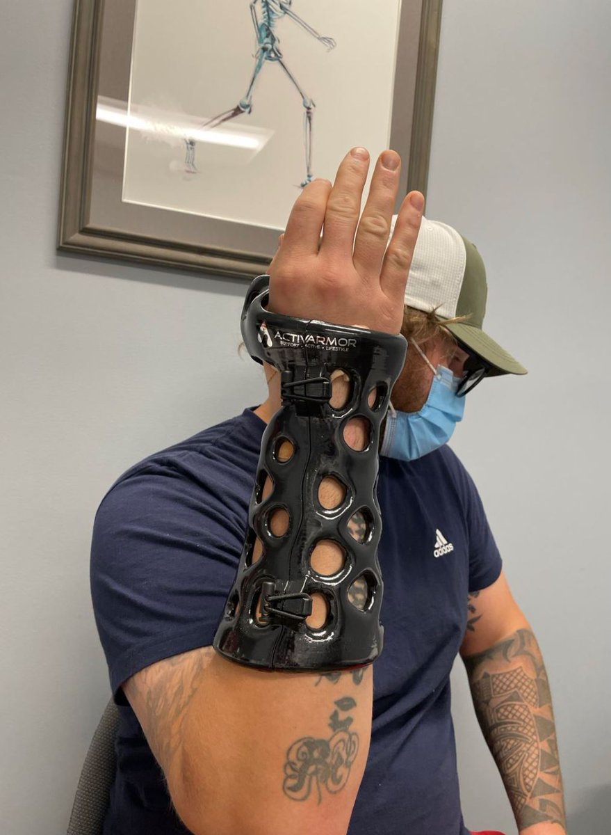 ActivArmor's tweet photo. #ActivArmor love it when a plan comes together. Thank you for the post Michael Redler, MD. With SCA Health @SCAHealth1 & Conneticut Orthopedics @ctorthopaedics
We're happy we could be of assistance.
#orthopedic #waterproofcast #plasticcast #3Dprintcast #3dprinted #investment https://t.co/CB3Uv320hA