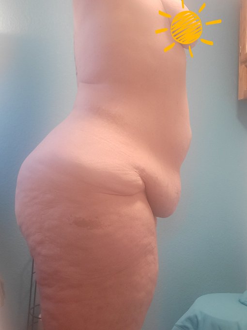 10 more days until FDL tummy tuck and brachialplasty https://t.co/AkLmxmIkZJ<a href="/tag/weightloss"class="tags"><span>#weightloss</span></a><a href="/tag/weightlossjourney"class="tags"><span>#weightlossjourney</span></a><a href="/tag/weightlosstransformation"class="tags"><span>#weightlosstransformation</span></a>