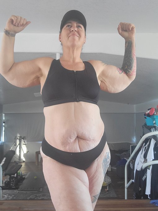Can't wait to get my brachialplasty on my arms. Ready to show my guns underneath 💪 https://t.co/3s52<a href="/tag/mvsales"class="tags"><span>#mvsales</span></a>