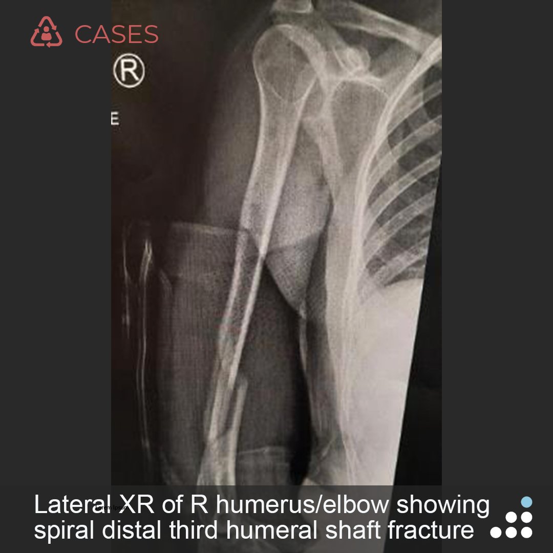 Orthobullets tweet media