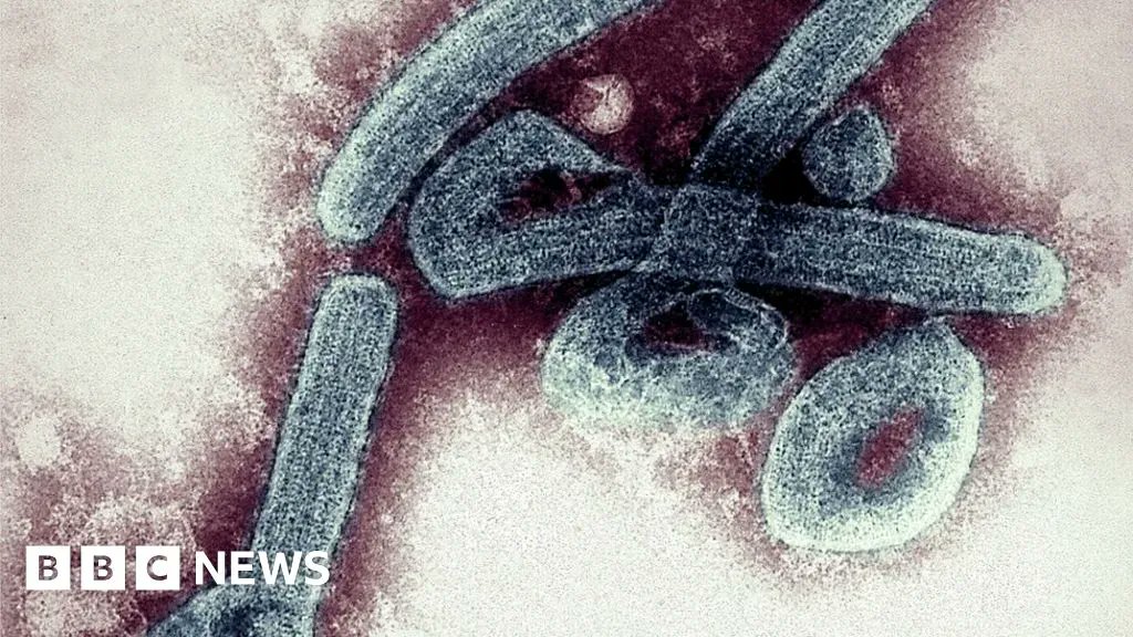 CarlosDeAliste's tweet image. 🇬🇭  Ghana has confirmed its first two cases of the deadly Marburg virus, a highly infectious disease in the same family as the virus that causes Ebola.

 🔗   buff.ly/3cooGRR