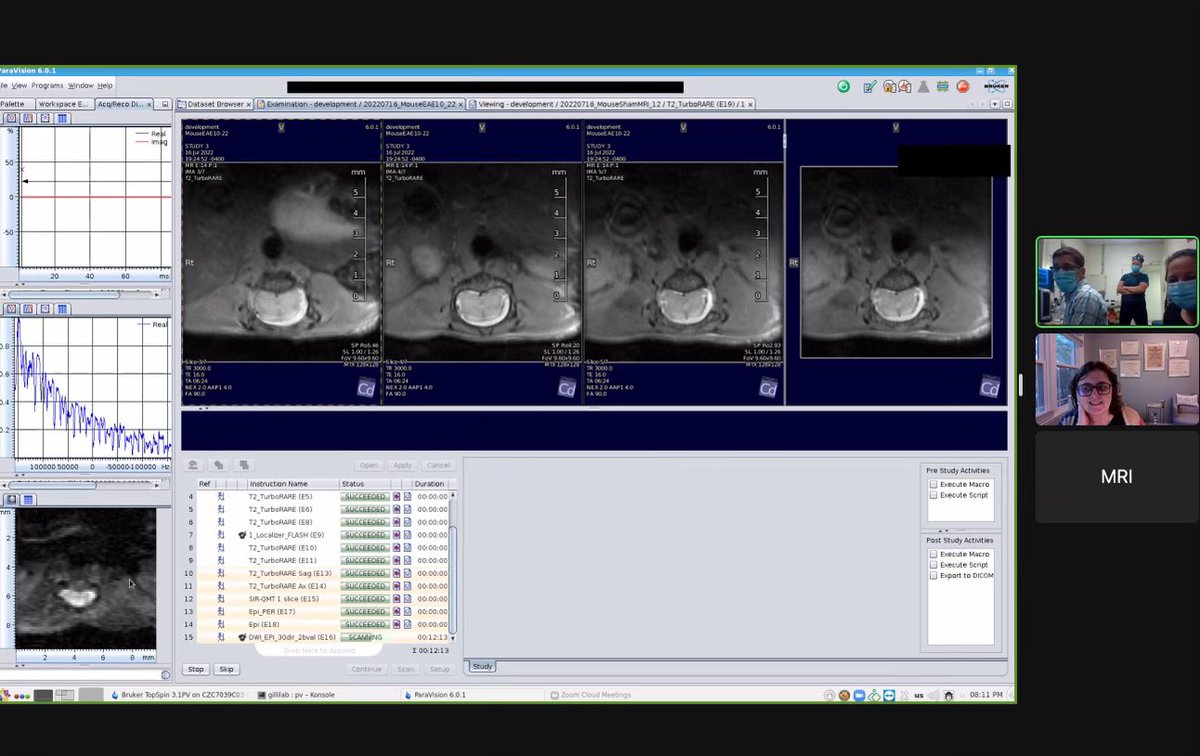Great science in the making. <a href="/BagnatoLab/">Francesca Bagnato and the NeuroImaging Unit</a> <a href="/NeuronswithNora/">Nora Welsh</a> <a href="/kharkins/">Kevin Harkins</a>
