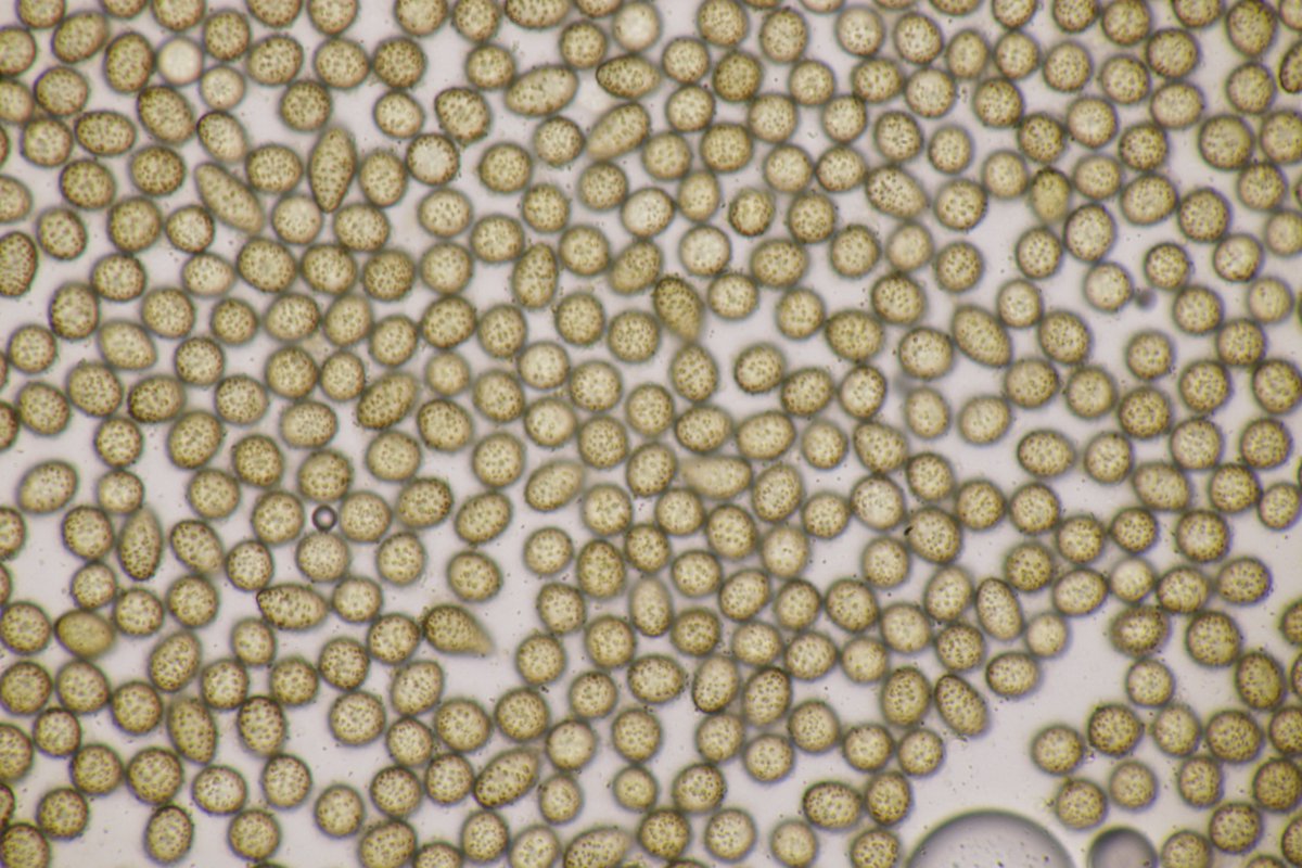 RPilze's tweet photo. Ustilago maydis ex Zea mays
#Ustilagomaydis #Ustilago #Brandpilz #Brand #smut #smutfungus #Zea #Zeamays #Mais #Maisbeulenbrand #Maisbrand #Cornsmut #huitlacoche #Charbondumaïs #cuitlacoche #mushroom #mushrooms #fungus #fungi #pilz #pilze #champignons #champignon #nature #natur https://t.co/O8Y3ckLbNX