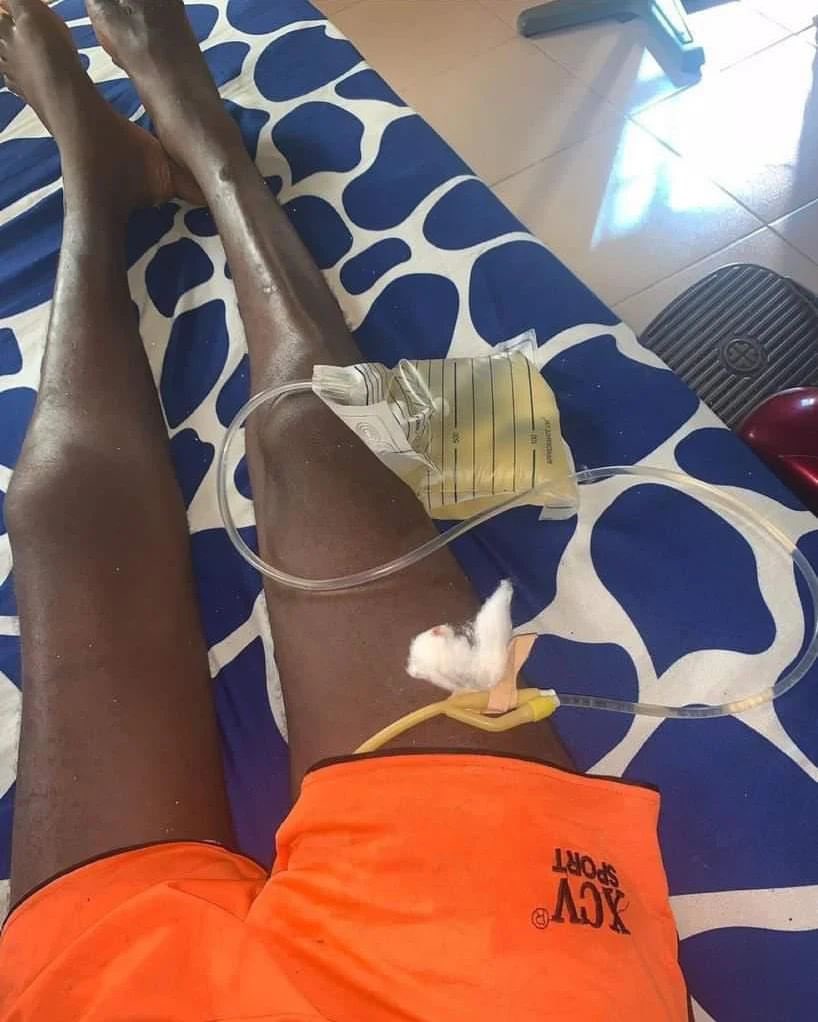 Pls I need a help My name is Tunde Lawal I was robbed &amp; shot at my backbone in a one chance commercial bus at oshodi while heading home from work at night which has left me unable to walk with my legs as we speak.The doctor suggested a surgery but money causes delay.Pls help Me🙏🏾
